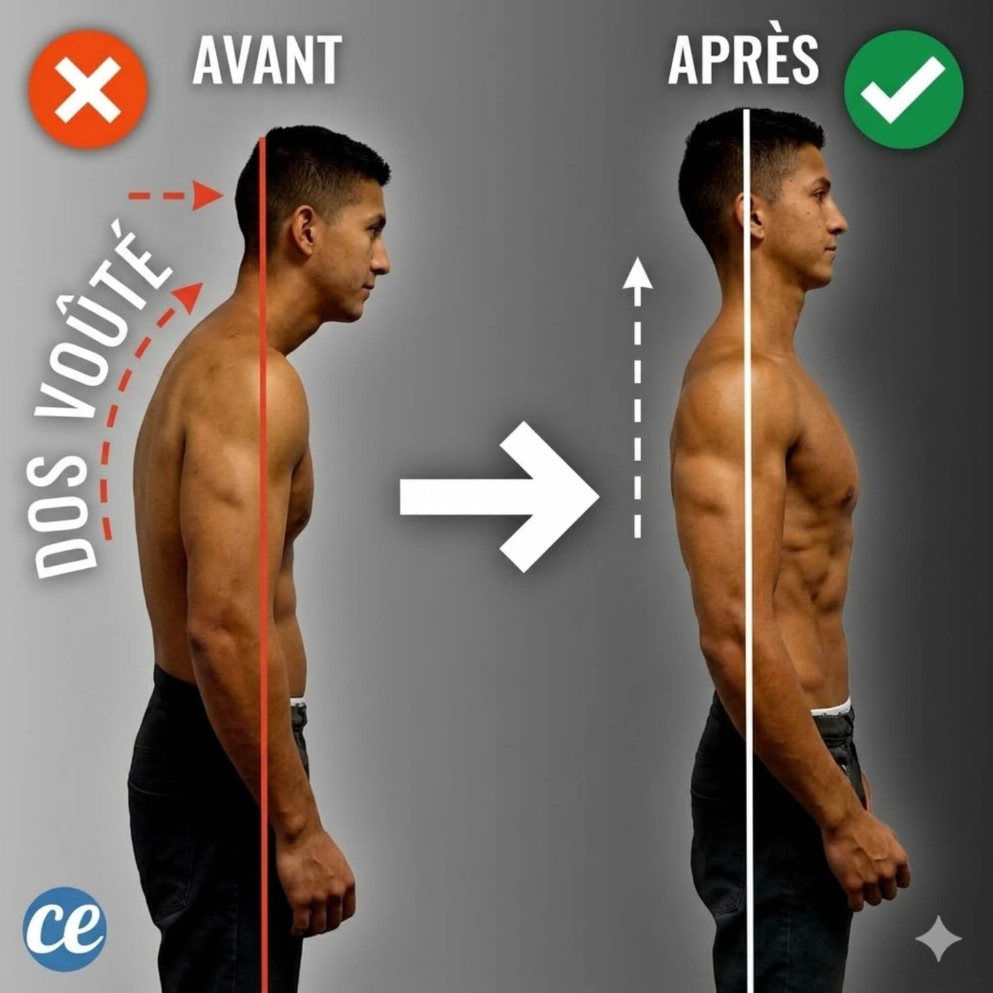 ALIGNORA™  Retrouver l’élégance d’une posture naturellement assurée