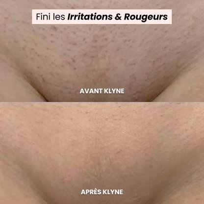 Épilateur & Rasoir Électrique 2-en-1