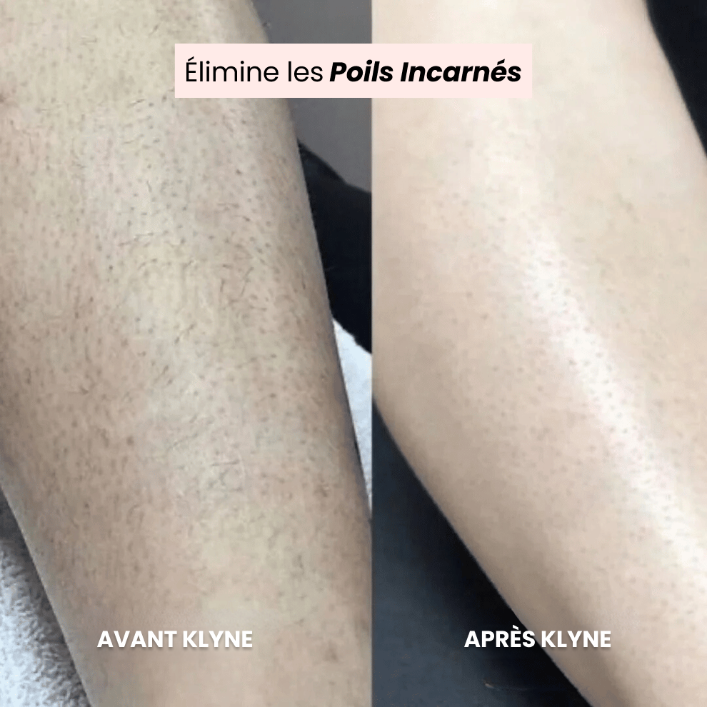 Épilateur & Rasoir Électrique 2-en-1